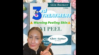 3rd VI Peel Treatment at Fresh Faces Rx