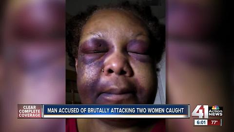 KC man charged with beating his 74-year-old girlfriend arrested in Texas