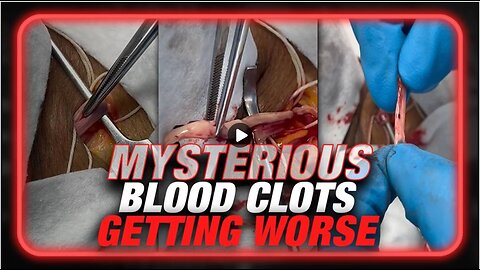 BREAKING Funeral Home Director Warns Mysterious Blood Clots Getting Worse