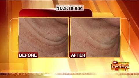 Improving Signs of Aging on the Neck