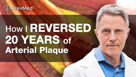 How I Reversed Arterial Plaque by 20 Years