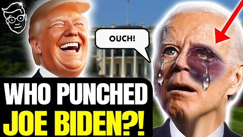 Biden Elder Abuse? Appears in Public With MASSIVE Mysterious BLACK Bruise On FACE!