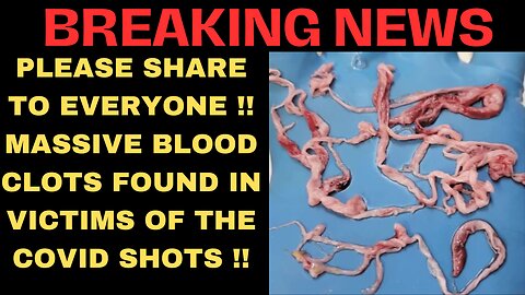 BREAKING NEWS: MASSIVE BLOOD CLOTS FOUND IN VICTIMS OF THE COVID SHOTS !!