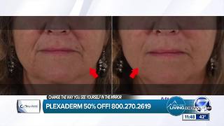 Plexaderm