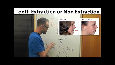 History of Teeth Alignment with Extraction or Non Extraction Method in Orthodontics by Dr Mike Mew