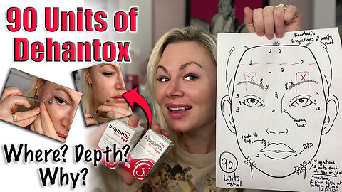 Let's do 90 Units of Dehantox: Where? Why? Depth! Botox At Home| Code Jessica10 Saves
