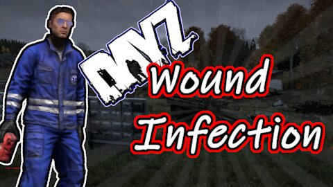 Guide to Wound Infection - Zombie Disease Tutorial DayZ 1.13 / 1.14 / 1.15 *Updated* Xbox One