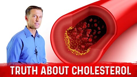 The Truth About Cholesterol – LDL Cholesterol & HDL Cholesterol – Dr.Berg