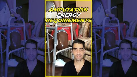 Amputation Energy Requirements