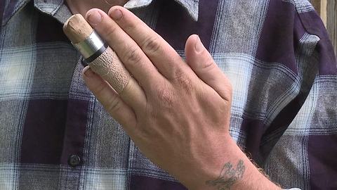 Nampa boy builds prosthetic finger for neighbor