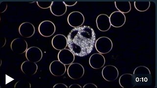 Active leucocyte under the Darkfield Microscope