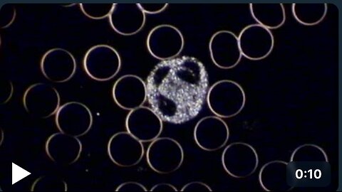 Active leucocyte under the Darkfield Microscope