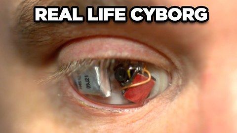 10 Real Life Cyborgs
