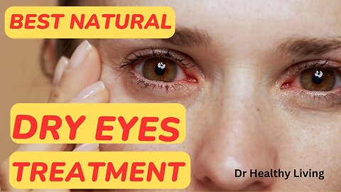 Best Natural Dry Eyes Treatment/Dr. Healthy Living