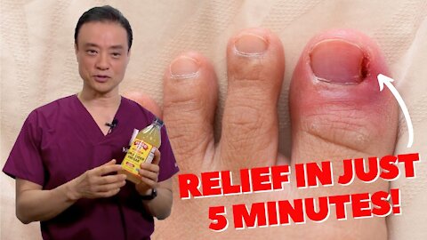 6 Home Remedies To Treat A Painful Ingrown Nail by Dr. Kim