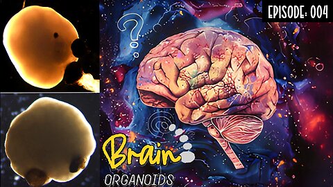 Pretty AntiSocial Podcast Episode 004: Brain Organoids