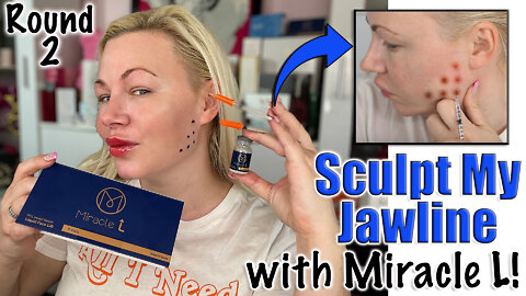 Sculpt my Jawline with Miracle L from AceCosm.com, Round 2 | Code Jessica10 Saves you Money!