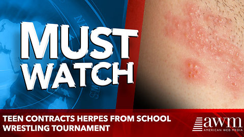 Teen Contracts Herpes From School Wrestling Tournament