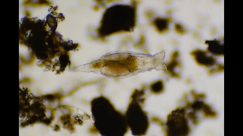 This Rotifer uses his cilia to create a vortex sucking bacteria into its mouth!