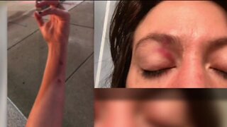 Detroit police corporal charged with assault in incident where journalists were hit with rubber projectiles