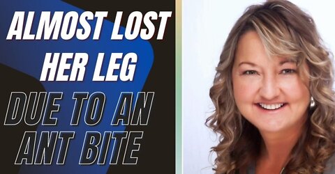This Woman Almost Lost Her Leg Due to an Ant Bite