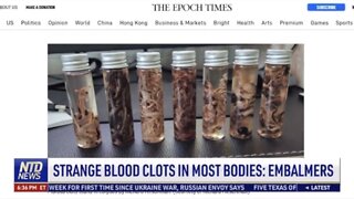 Covid Vaccine Side Affect 🚨 Mysterious clots being found in dead people during embalming