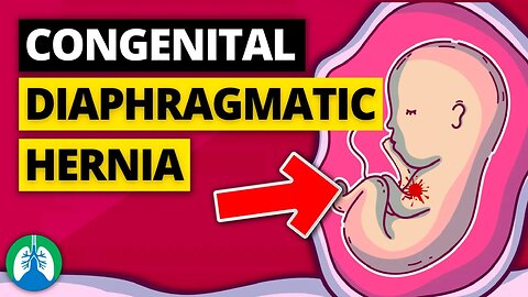 Congenital Diaphragmatic Hernia (Medical Definition) | Explainer Video