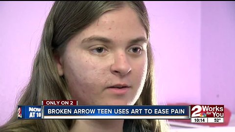 BA teen uses art to ease pain from CRPS