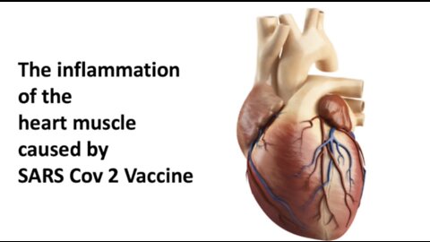 Dr. Joseph Thoma - The inflammation of the heart muscle caused by SARS Cov 2 vaccine 2-22-2022