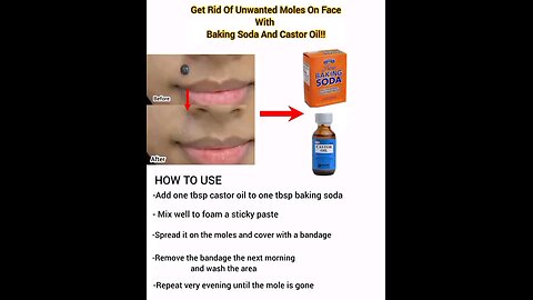 how to remove unwanted moles from your face