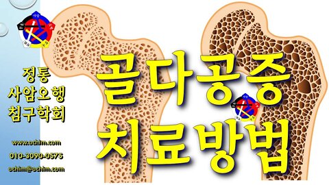 골다공증 치료 방법 - 비과학적 양의학 170 - 사암침, 사암침법