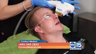 Contour Medical: How to get younger looking skin with no downtime and no pain