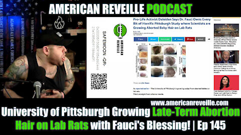 University of Pittsburgh Growing Late-Term Abortion Hair on Lab Rats with Fauci's Blessing! | Ep 145