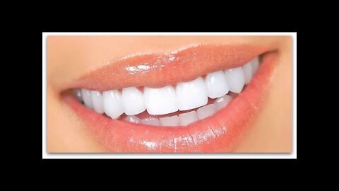 Natural Teeth Whitener