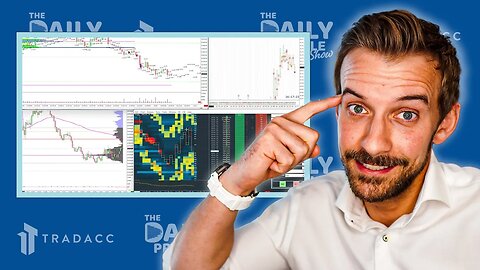 Why You Should Track Your Trades!