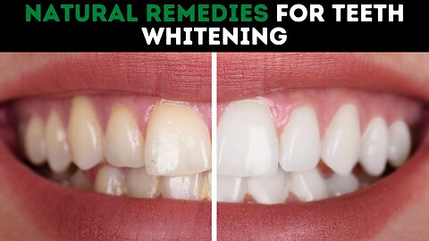 Natural Remedies For Teeth Whitening
