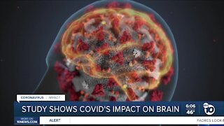 Study shows how COVID-19 attacks brain cells