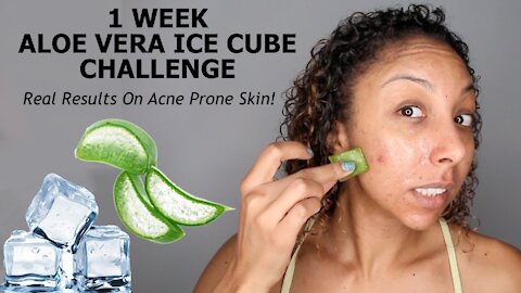 1 Week Aloe Vera ICE CUBE Challenge! REAL RESULTS! ACNE Skincare Update! | BiancaReneeToday