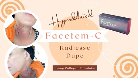 Facetem-C CaHA Hyperdilution Radiesse DUPE SASSY15 saves 15% at Estaderma