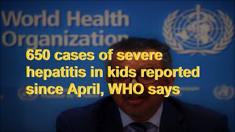 650 cases of severe hepatitis in kids reported since April, WHO says