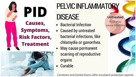How to treat pelvic inflammatory disease