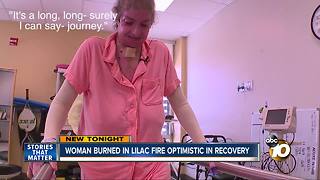 Woman burned in Lila Fire optimistic in recovery