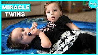 Our Conjoined Twins Were Given 24 Hours To Live | MY EXTRAORDINARY FAMILY