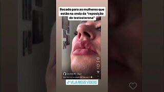 Mulher fica barbada devido aos esteroides