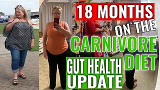 18 Months on Carnivore Diet Update - Healing SIBO Naturally, IBS Diarrhea Gone? Visceral Fat Down