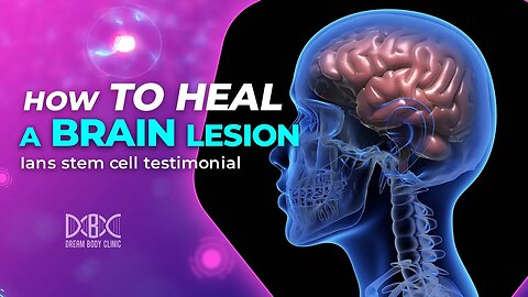 How to Heal a Brain Lesion - Ians Stem Cell Testimonial