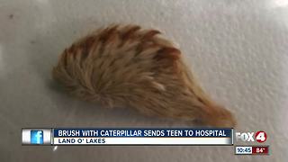 Venomous caterpillar sends Florida teen to hospital