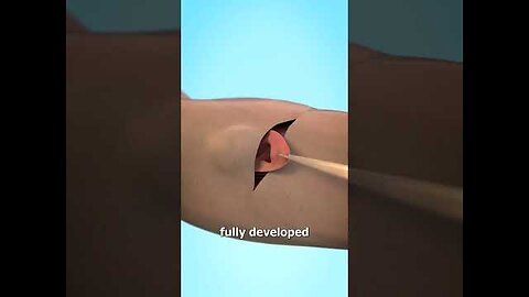 Growing An Ear In Your Arm 😨