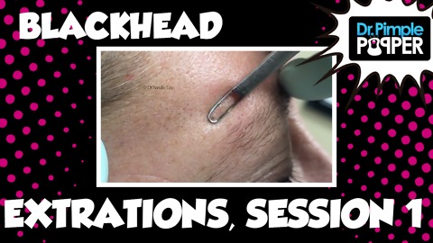 Blackheads Session One, Pre Prep