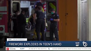 Teen hospitalized after firework explodes in his hand